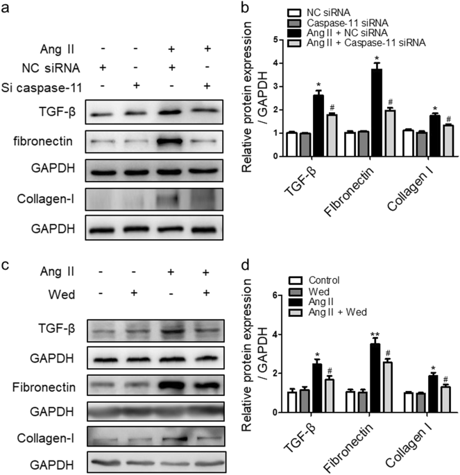 caspase 11 promotes renal fibrosis by stimulating il 1β maturation