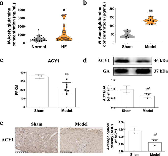 Aminoacylase-1 plays a key role in myocardial fibrosis and the therapeutic effects of 20(s)-ginsenoside rg3 in mouse heart failure