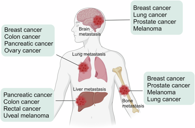 The role of calcium signaling in organotropic metastasis of cancer ...