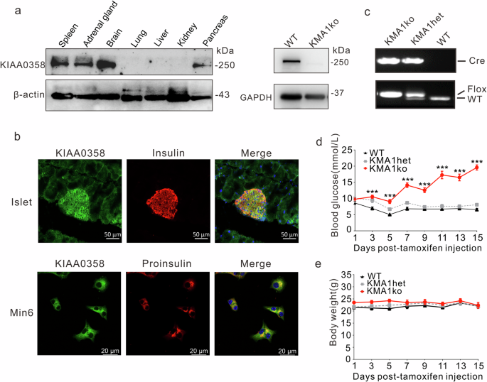 IG20/MADD gene functional isoform KIAA0358 can promote insulin secretion in glucose and repaglinide-induced pancreatic β-cells