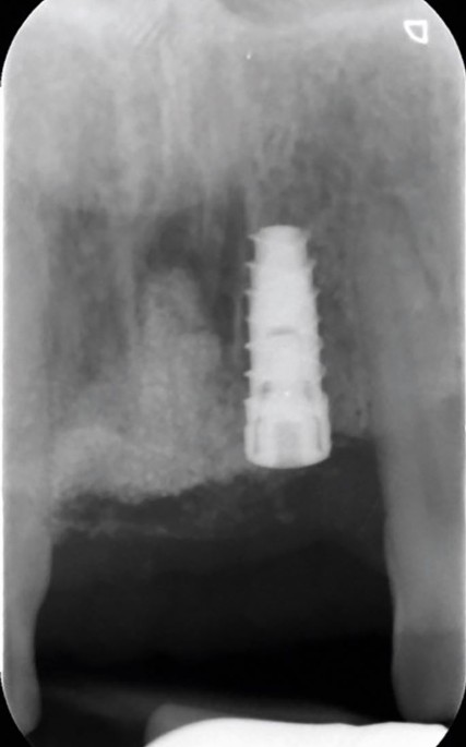 feature-image