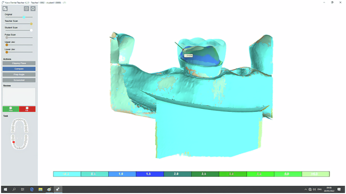 Effectiveness of a digital educational system on the learners’ performance in preclinical fixed prosthodontic training