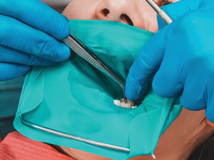 What Is a Dental Dam & How to Use It