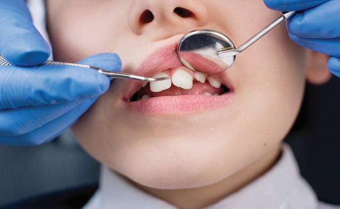 The Role Of Dental Hygienists And Therapists In Paediatric Oral Healthcare In Scotland Bdj Team