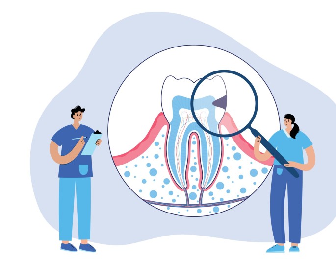 How to manage tooth erosion | BDJ Team