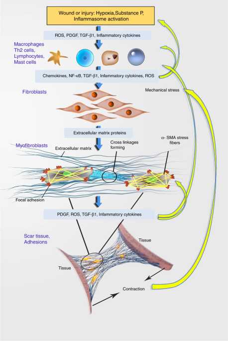 Pathological mechanisms and therapeutic outlooks for arthrofibrosis