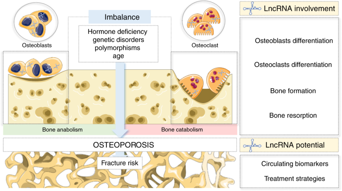 Long noncoding RNAs: a missing link in osteoporosis | Bone Research Long noncoding RNAs: a missing link in osteoporosis | Bone Research