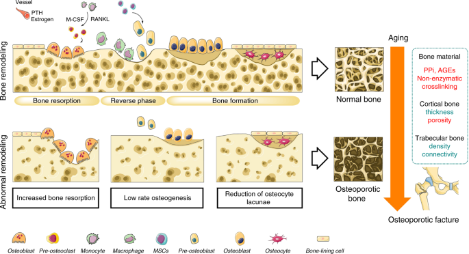 Bench-to-bedside strategies for osteoporotic fracture: From osteoimmunology  to mechanosensation | Bone Research