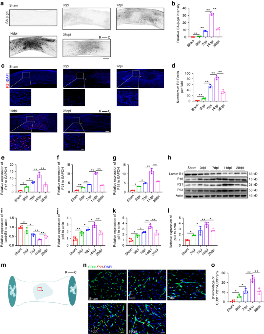 Kdm6a-CNN1 axis orchestrates epigenetic control of trauma-induced ...