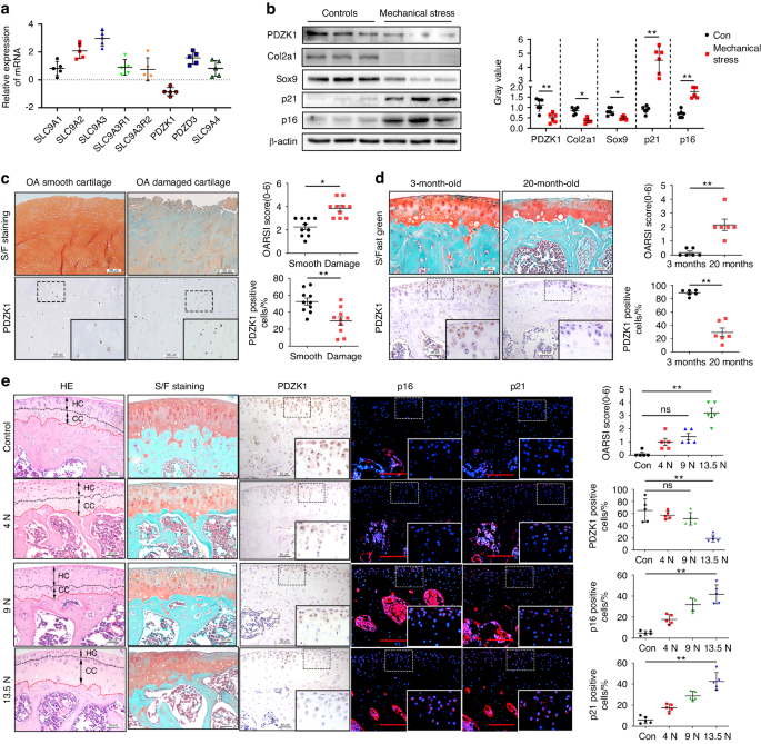 Pdzk1 protects against mechanical overload-induced chondrocyte senescence and osteoarthritis by targeting mitochondrial function