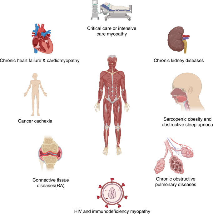 Pathophysiology of Myopenia in rheumatoid arthritis