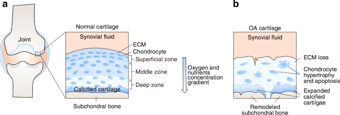 The impact of mitochondrial dysfunction on osteoarthritis cartilage: current insights and emerging mitochondria-targeted therapies | Bone Research The impact of mitochondrial dysfunction on osteoarthritis cartilage: current insights and emerging mitochondria-targeted therapies | Bone Research