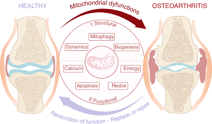 glutathione and osteoarthritis Exploring mitochondrial functions and dysfunctions in chondrocytes: toward the identification of novel therapies for osteoarthritis