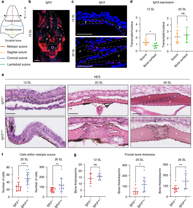 Fgfr3-Wnt signaling crosstalk is involved in maintaining cranial suture integrity - Bone Research