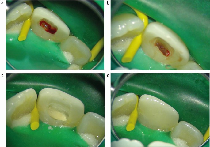 feature-image