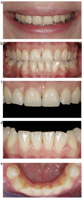 Digital photography in Dentistry: Techniques and clinical importance