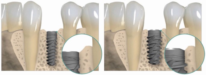 feature-image