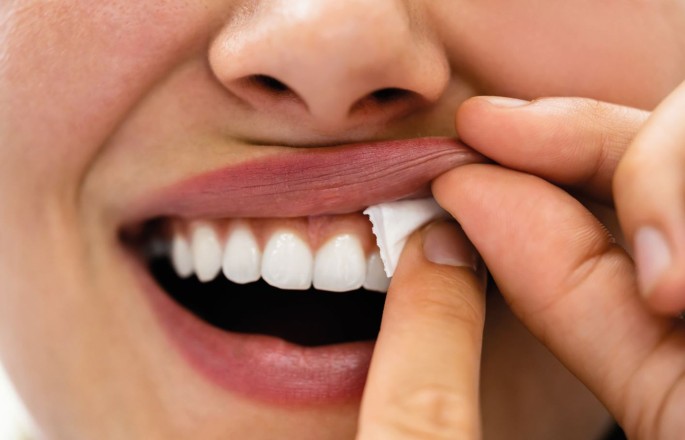 Nicotine pouches: a review for the dental team | British Dental Journal