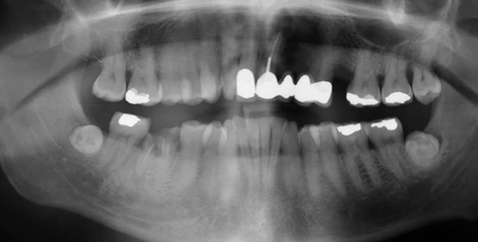 The introduction of a safe discharge network for the ongoing oral healthcare of patients who have completed management for head and neck cancers