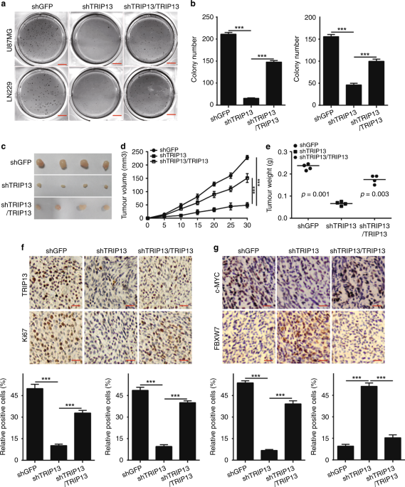 TRIP13 promotes the cell proliferation, migration and invasion of  glioblastoma through the FBXW7/c-MYC axis
