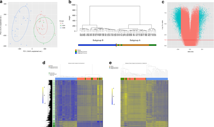 Clinically and biologically relevant subgroups of Wilms tumour defined ...