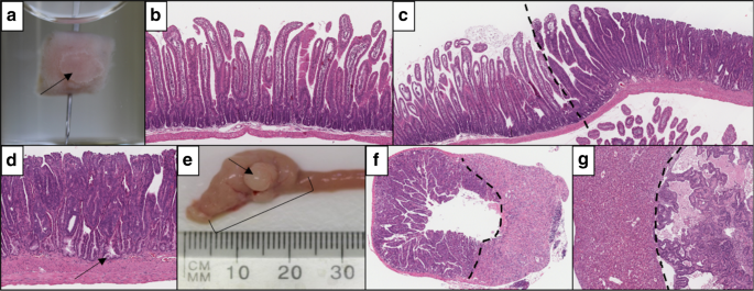 Aspirin reduces the incidence of metastasis in a pre-clinical study of braf mutant serrated colorectal neoplasia