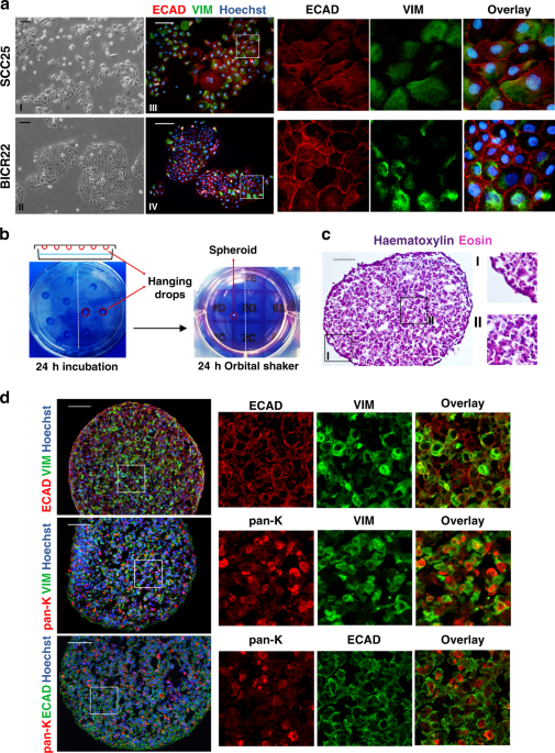 A Wnt-mediated phenotype switch along the epithelial–mesenchymal axis  defines resistance and invasion downstream of ionising radiation in oral  squamous cell carcinoma | British Journal of Cancer