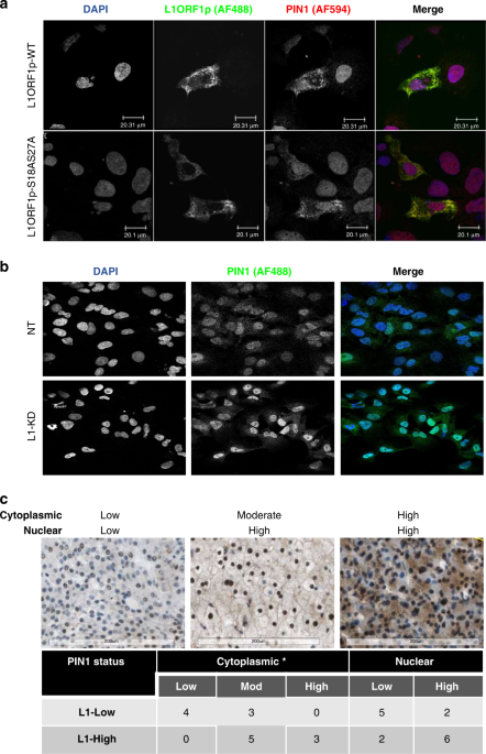 Impact of retrotransposon protein L1 ORF1p expression on oncogenic pathways  in hepatocellular carcinoma: the role of cytoplasmic PIN1 upregulation