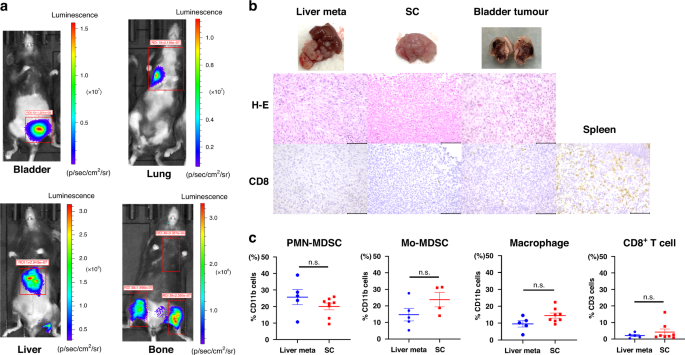Irradiation plus myeloid-derived suppressor cell-targeted therapy for overcoming treatment resistance in immunologically cold urothelial carcinoma