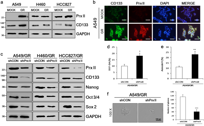 Microrna 122 Negatively Associates With Peroxiredoxin Ii Expression In Human Gefitinib Resistant Lung Cancer Stem Cells Cancer Gene Therapy
