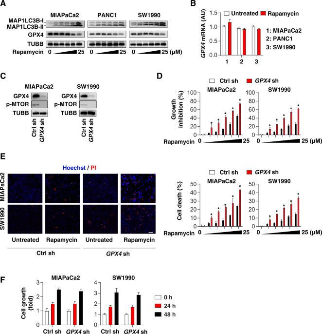 Interplay between mtor and gpx4 signaling modulates autophagy-dependent ferroptotic cancer cell death