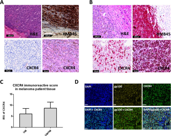 Non-invasive detection and complementary diagnostic of liver metastases via  chemokine receptor 4 imaging | Cancer Gene Therapy
