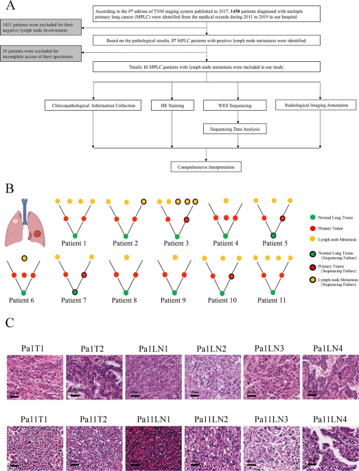 Genetic trajectory and clonal evolution of multiple primary lung cancer with lymph node metastasis