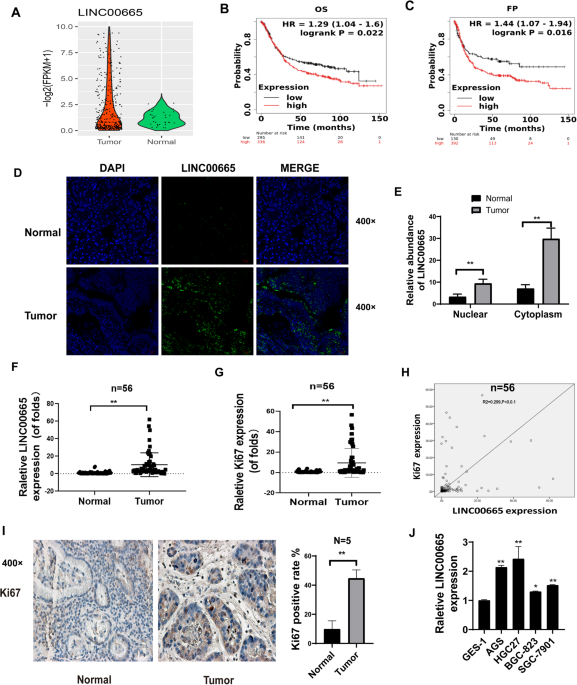 Linc00665 activating wnt3a/β-catenin signaling by bond with ybx1 promotes gastric cancer proliferation and metastasis
