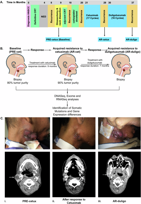 glutathione head and neck cancer Switching anti-EGFR antibody re-sensitizes patient following acquired resistance to cetuximab Kojic Acid and Glutathione