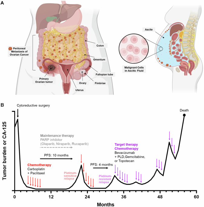 semaglutide and ovarian cancer AAV for ovarian cancer gene therapy