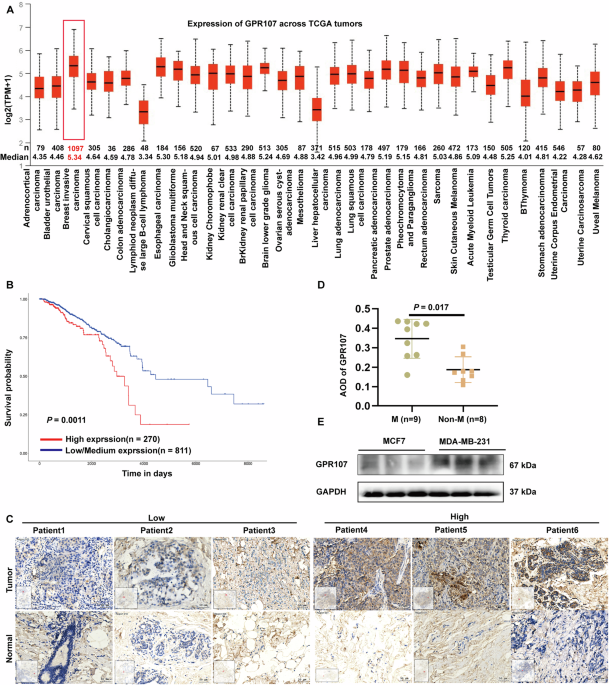 GPR107: A key driver of breast cancer invasion and metastasis through ...