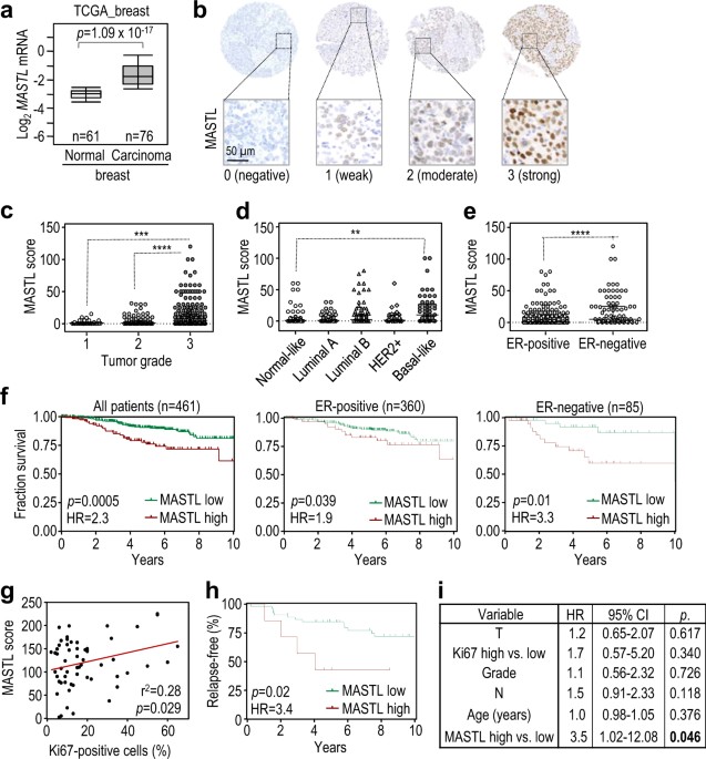 ... breast tissues (n = 61) in the TCGA breast cancer cohort (Oncomine database). b Immunohistochemical detection of MASTL in breast cancer samples, showing ... Therapeutic relevance of the PP2A-B55 inhibitory kinase MASTL ...