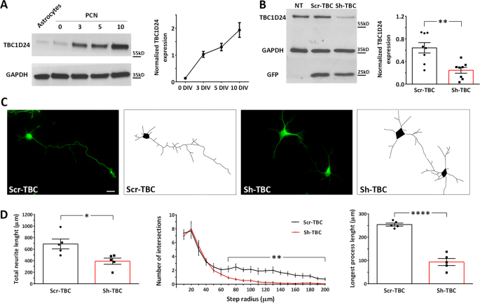 Tbc1d24 Regulates Axonal Outgrowth And Membrane Trafficking At The Growth Cone In Rodent And Human Neurons Cell Death Differentiation Tbc1d24 Regulates Axonal Outgrowth And Membrane Trafficking At The Growth Cone In Rodent And Human Neurons Cell Death Differentiation