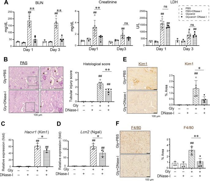 dsDNA-induced AIM2 pyroptosis halts aberrant inflammation during rhabdomyolysis-induced acute kidney injury