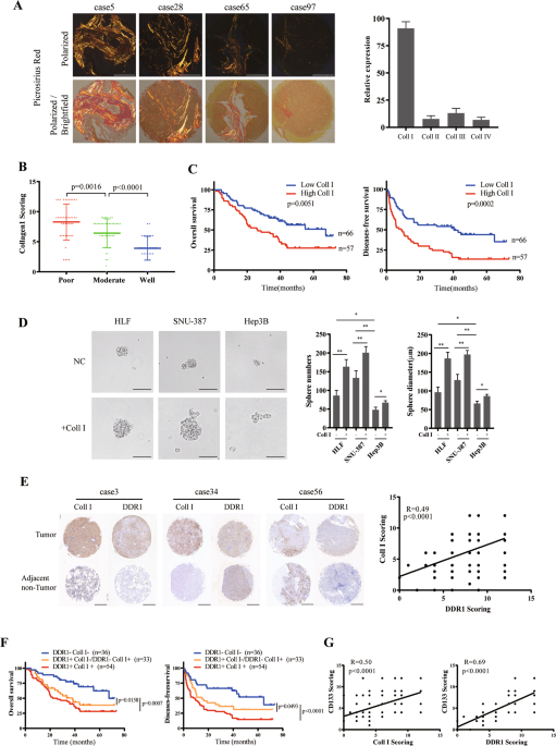 Collagen I-DDR1 signaling promotes hepatocellular carcinoma cell stemness  via Hippo signaling repression | Cell Death & Differentiation