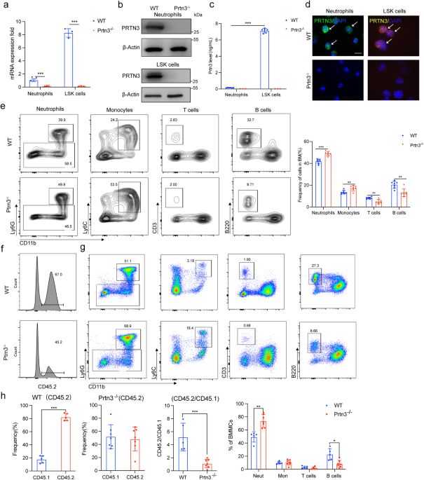 Proteinase 3 depletion attenuates leukemia by promoting myeloid differentiation