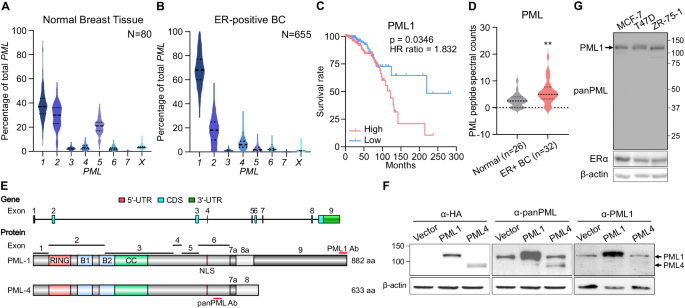 The pml1-wdr5 axis regulates h3k4me3 marks and promotes stemness of estrogen receptor-positive breast cancer