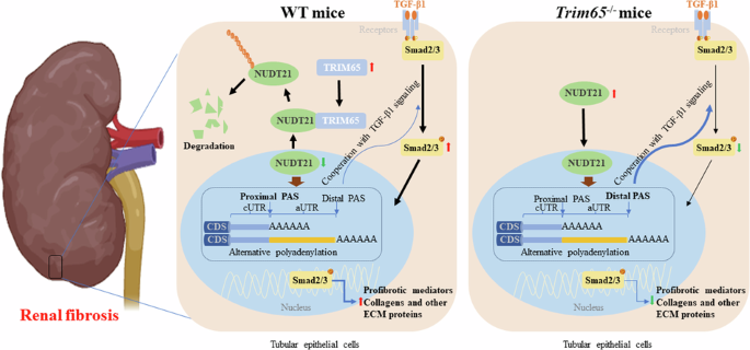 Trim65 deficiency alleviates renal fibrosis through nudt21-mediated alternative polyadenylation