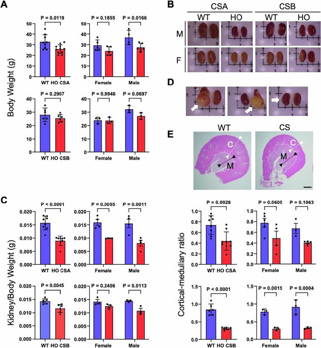 Cockayne syndrome mice reflect human kidney disease and are defective in de novo NAD biosynthesis