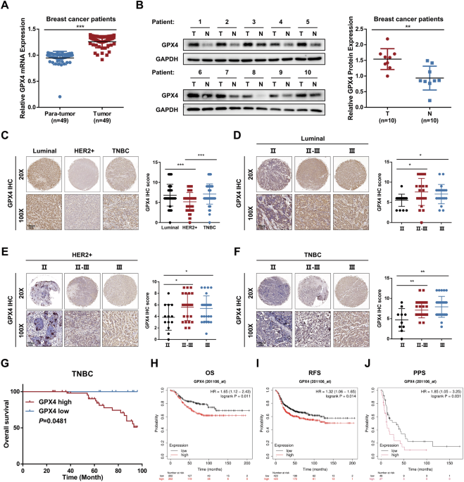 is glutathione safe for breast cancer patients Antioxidants the Treatment of Cancer: Are We There Yet? Study Finds Cancer Cells Use