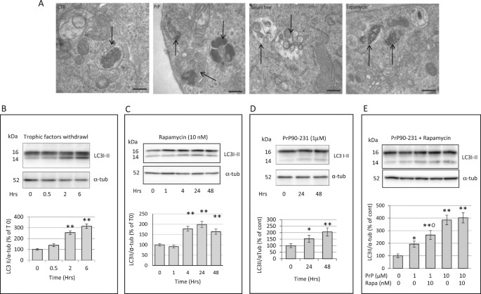 pharmacological activation of autophagy favors the clearing of da form 67 10 1a