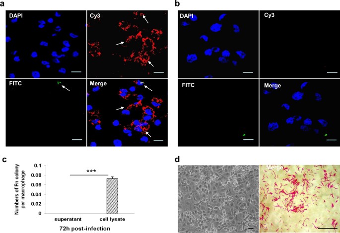 Indoleamine 2,3-dioxygenase expression regulates the survival and proliferation of Fusobacterium nucleatum in THP-1-derived macrophages