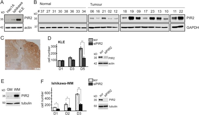 Pir2/rnf144b is a potential endometrial cancer biomarker that promotes cell proliferation