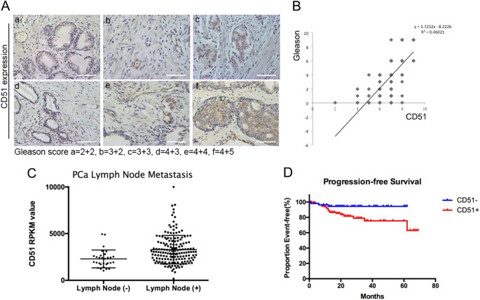 P53-dependent cd51 expression contributes to characteristics of cancer stem cells in prostate cancer